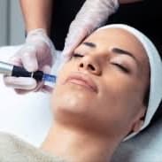 Microneedling Glow Series of 4 at Katie Rose Aesthetics in Coeur D Alene, ID